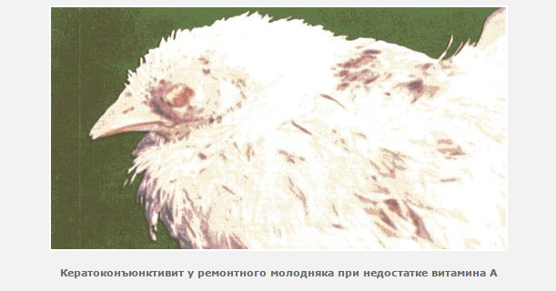 Пяточная шпора