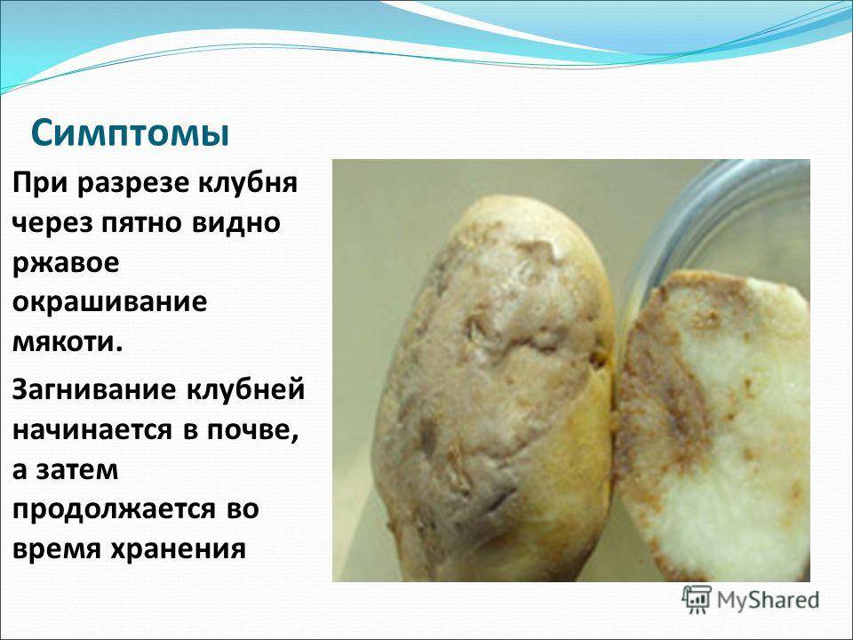 Сердечно-сосудистые заболевания: классификация, симптомы, диагностика